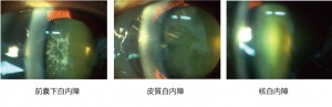 cat_asc_cortical_nuclear
