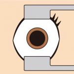 器具を使って目を開けます。